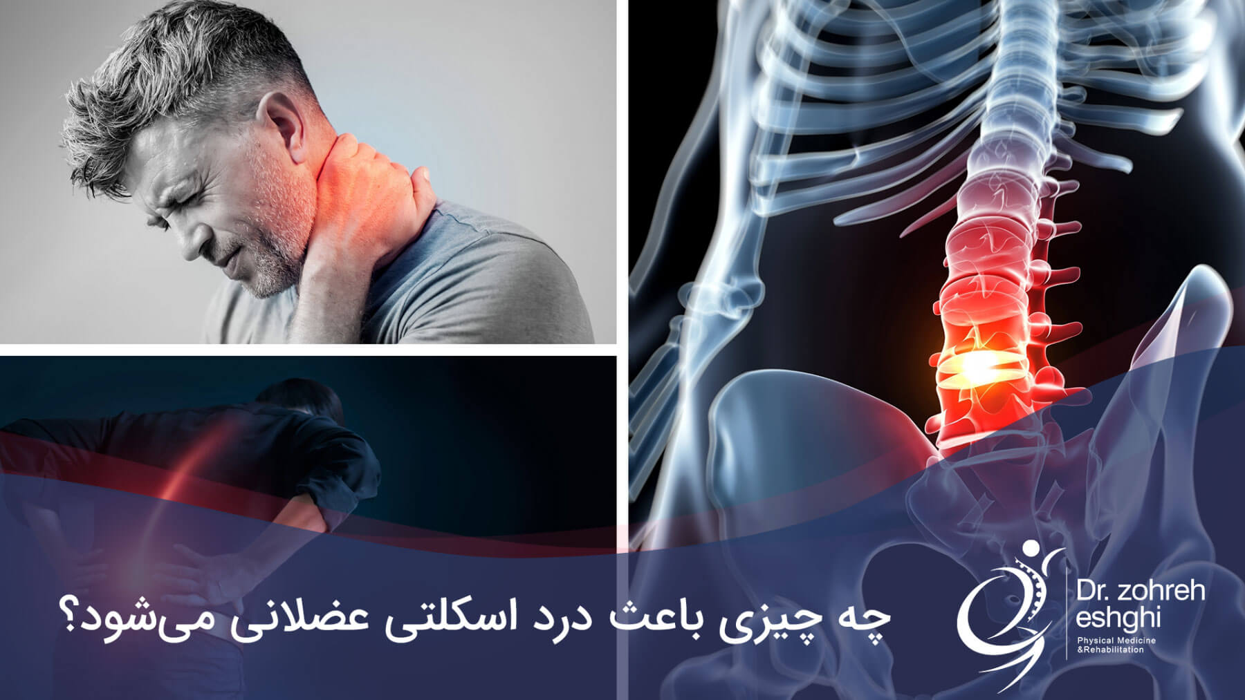 درمان درد اسکلتی عضلانی در شیراز