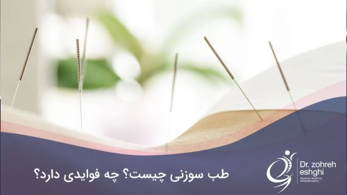 طب سوزنی