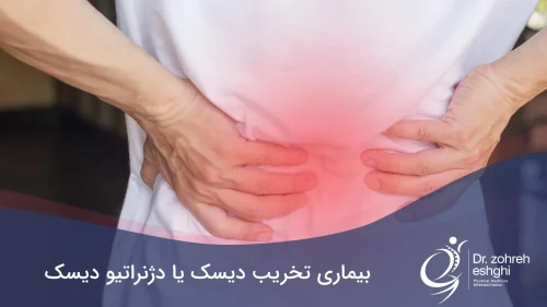 بیماری تخریب دیسک یا دژنراتیو دیسک