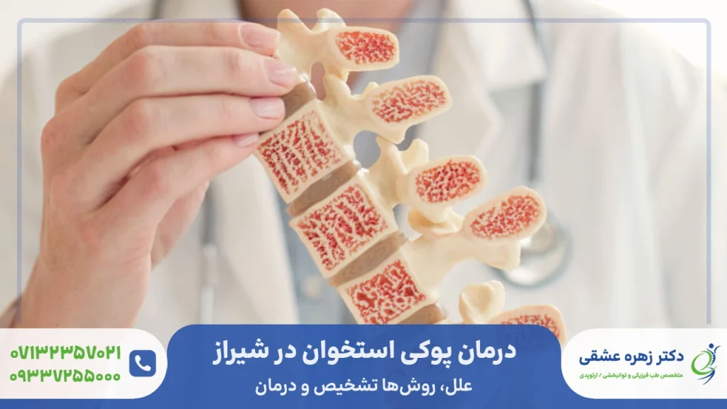 درمان پوکی استخوان در شیراز