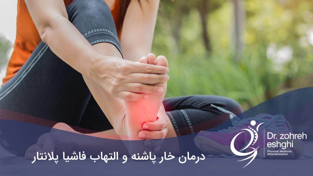 درمان خار پاشنه و التهاب فاشیا پلانتار