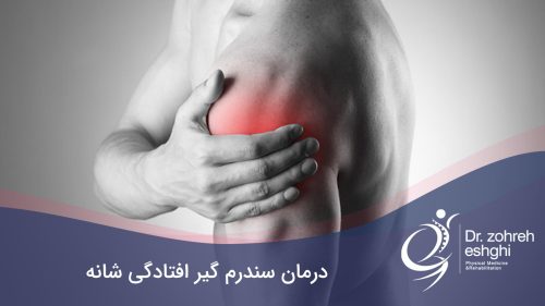 درمان سندرم گیر افتادگی شانه