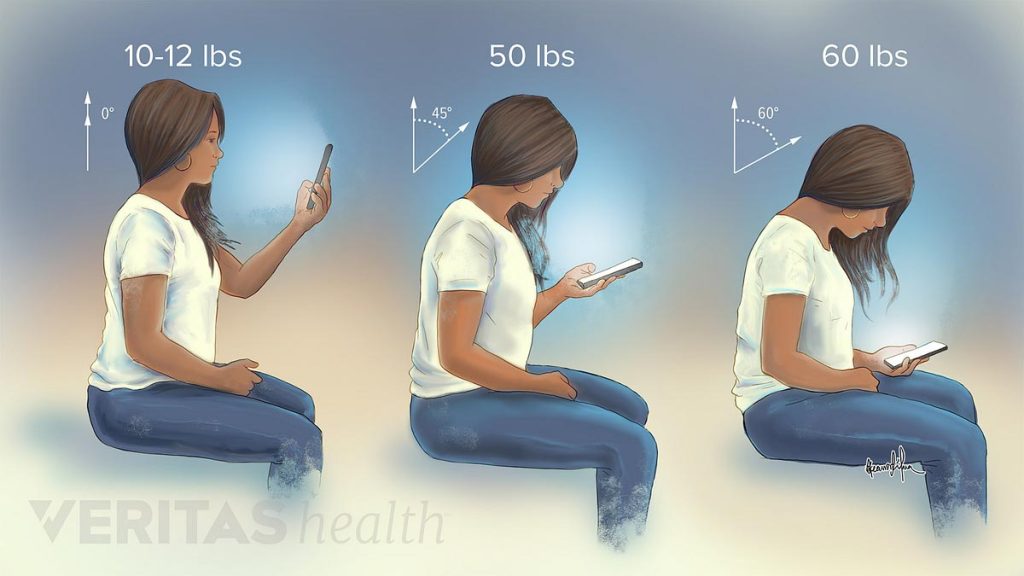 پیشگیری از درد گردن در هنگام کار با موبایل