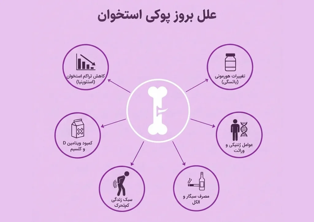 علل و دلایل اصلی پوکی استخوان