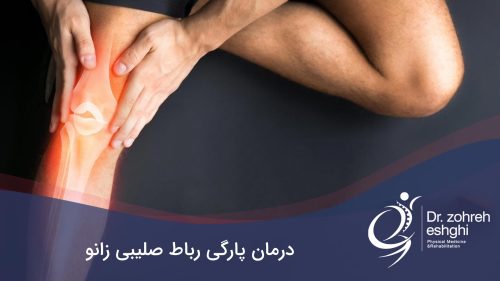 درمان پارگی رباط صلیبی زانو