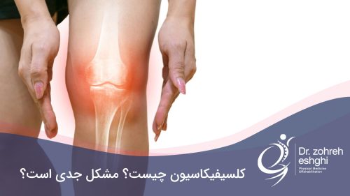 کلسیفیکاسیون