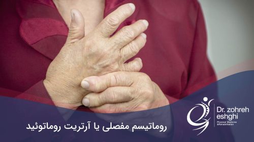 روماتیسم مفصلی