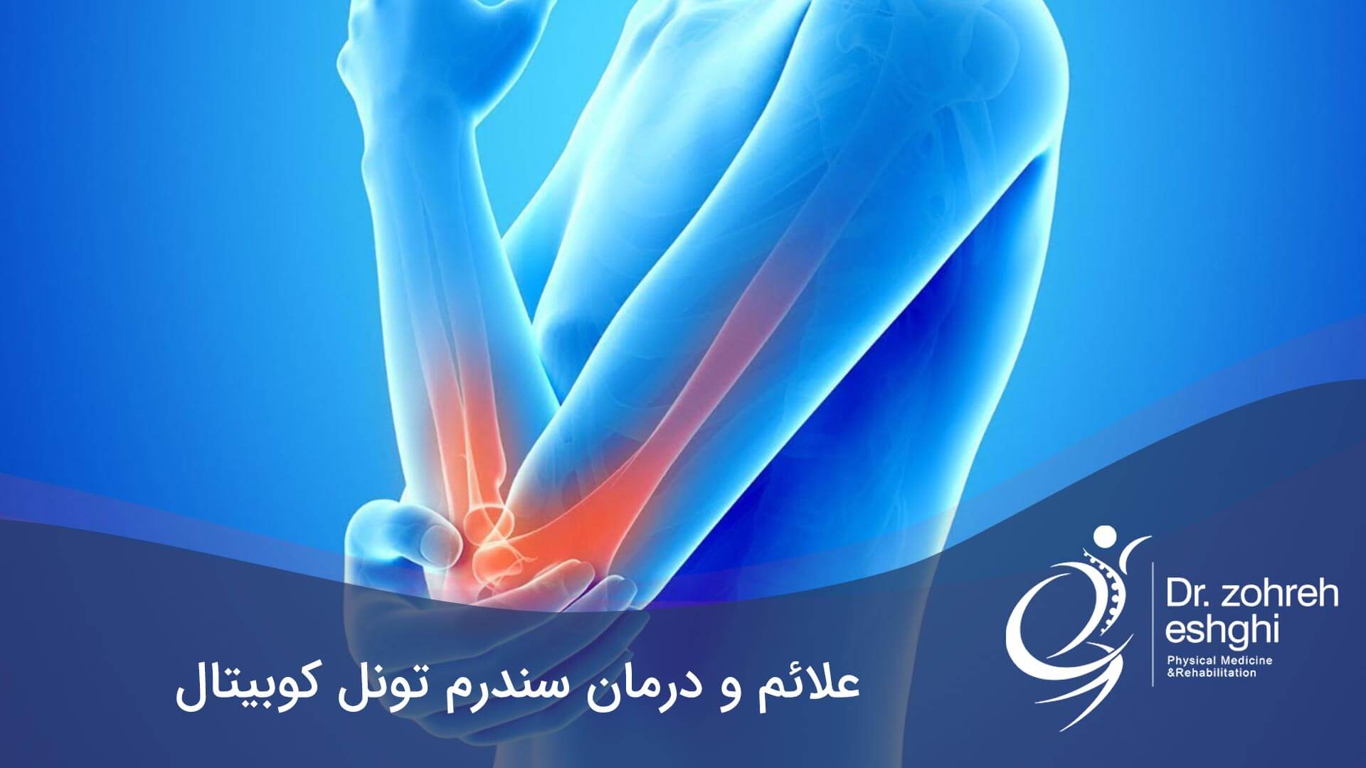 سندرم تونل کوبیتال + علائم و درمان در شیراز