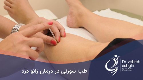طب سوزنی زانو