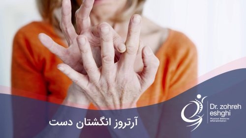 علائم و درمان آرتروز انگشتان دست