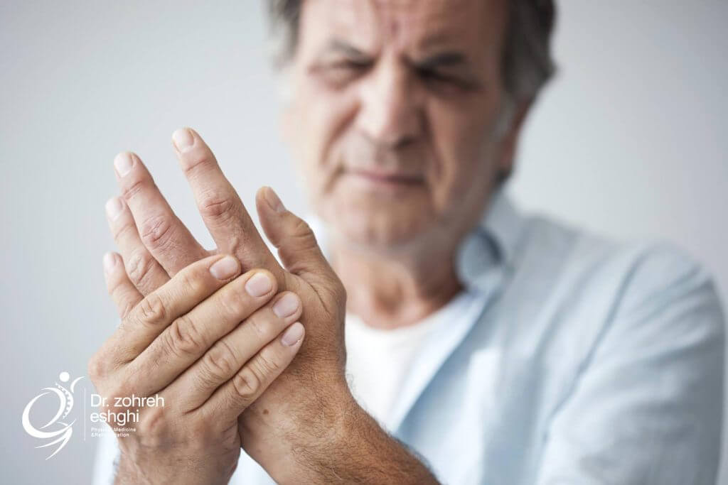 درمان آرتروز انگشتان دست