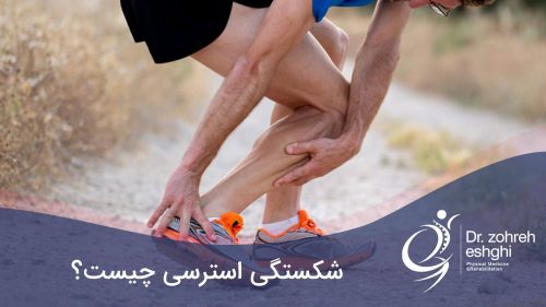 شکستگی استرسی