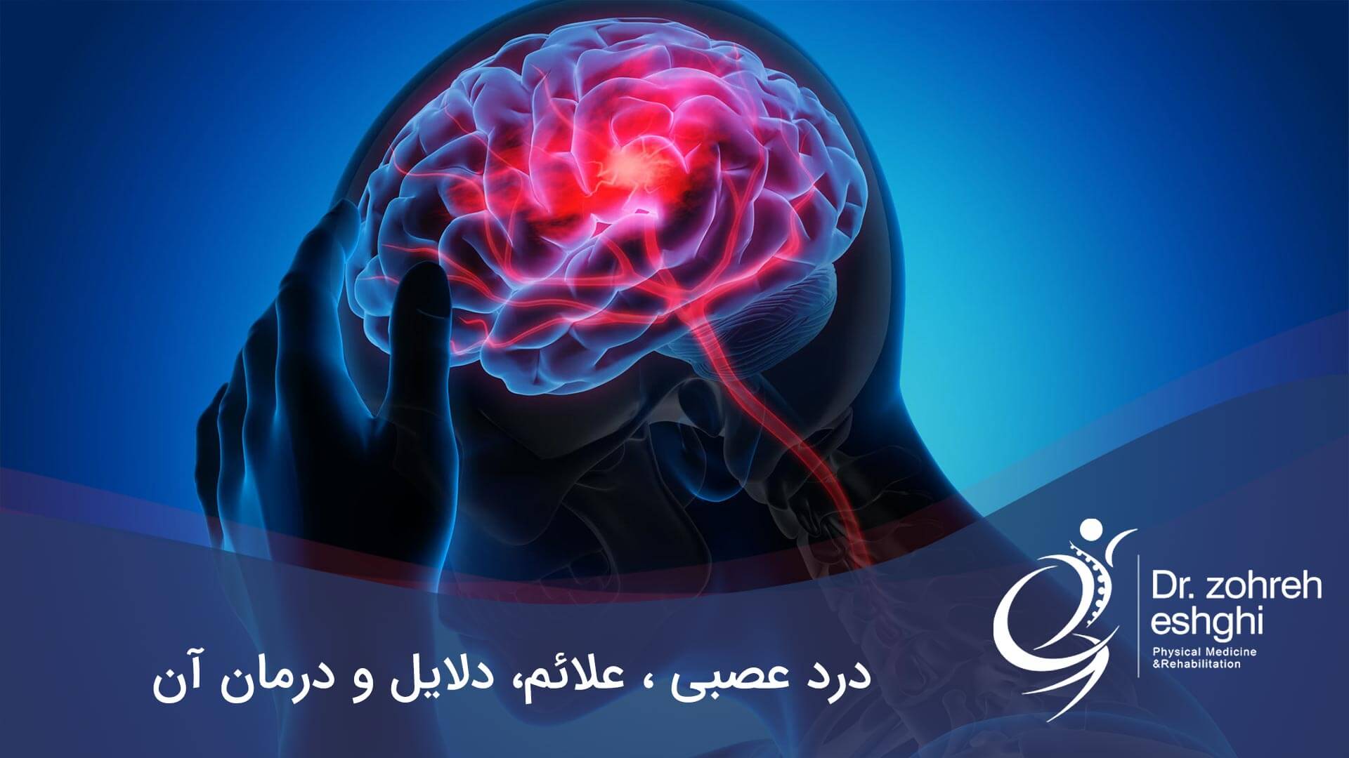 درمان درد عصبی در شیراز + علائم و دلایل آن