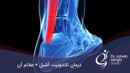 تاندونیت آشیل