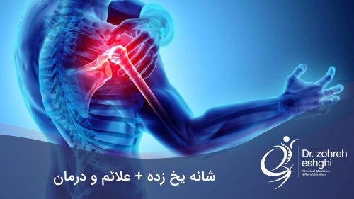 شانه یخ زده