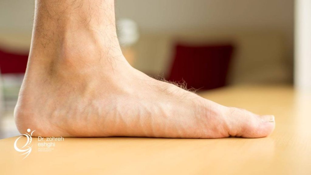 علائم صافی کف پا چیست؟