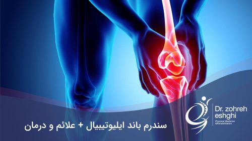 سندرم باند ایلیوتیبیال
