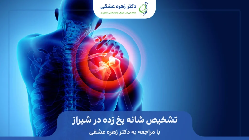 تشخیص شانه یخ زده در شیراز