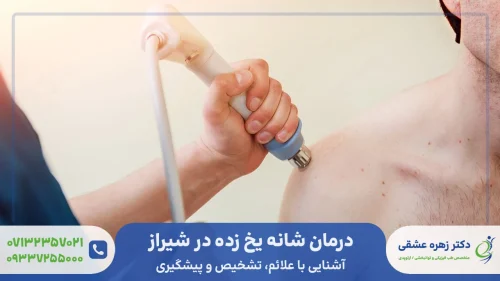 درمان شانه یخ زده در شیراز