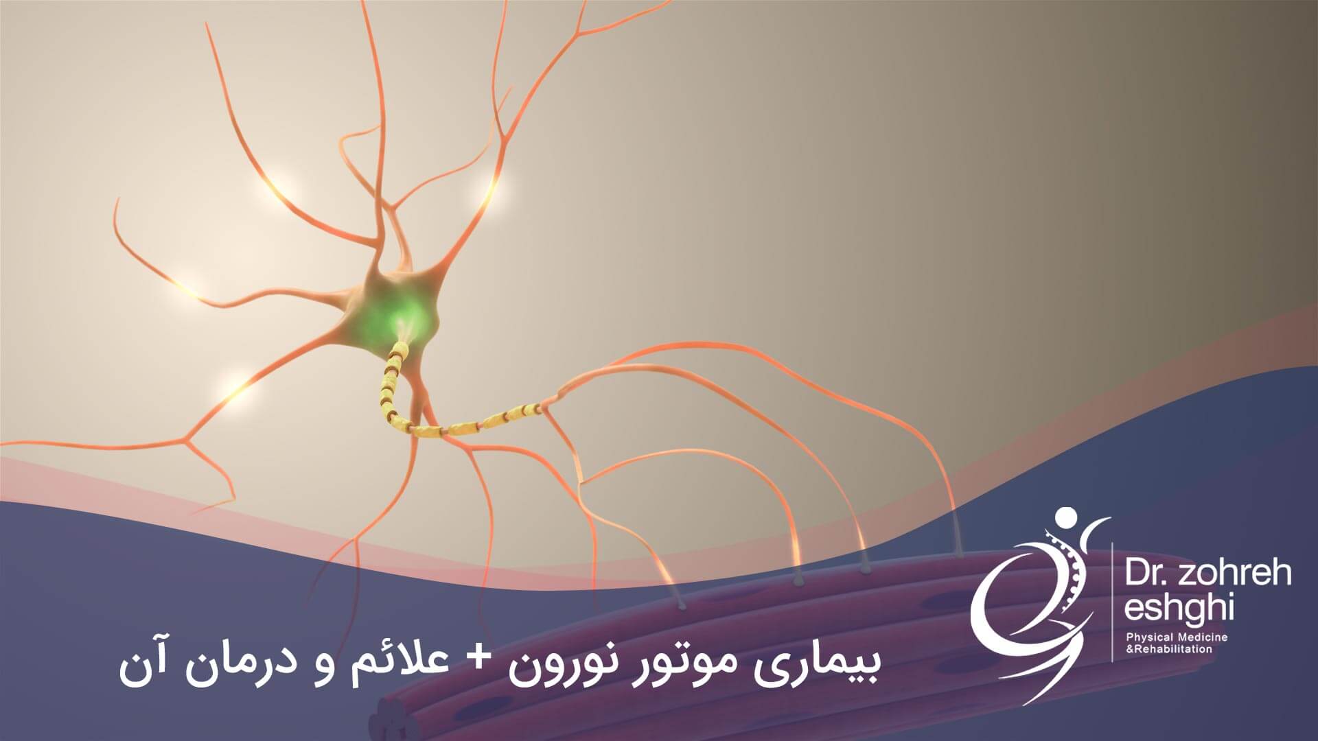 بیماری موتور نورون + علائم و درمان آن