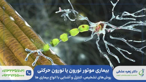 مطلب جامع در خصوص بیماری موتور نورون یا نورون حرکتی + علائم و درمان آن