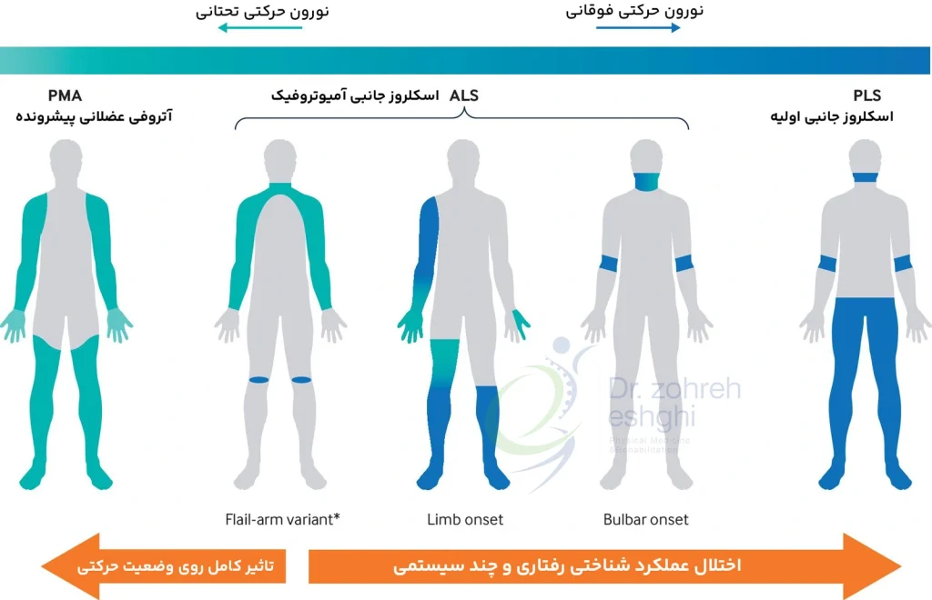 شکل وکتور انواع بیماری های نورون حرکتی و تاثیر آن روی بدن
