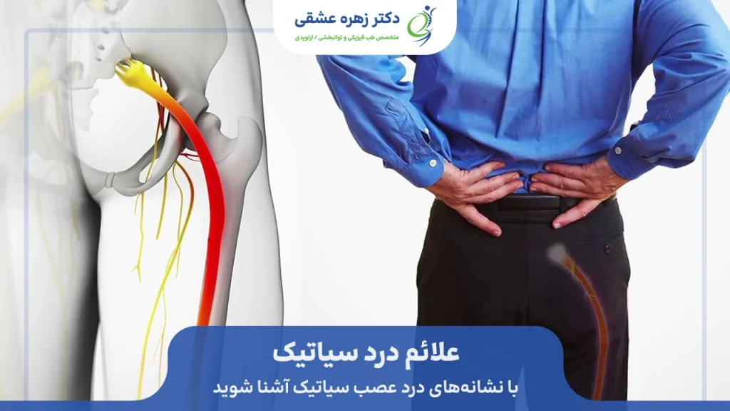 علائم درد سیاتیک
