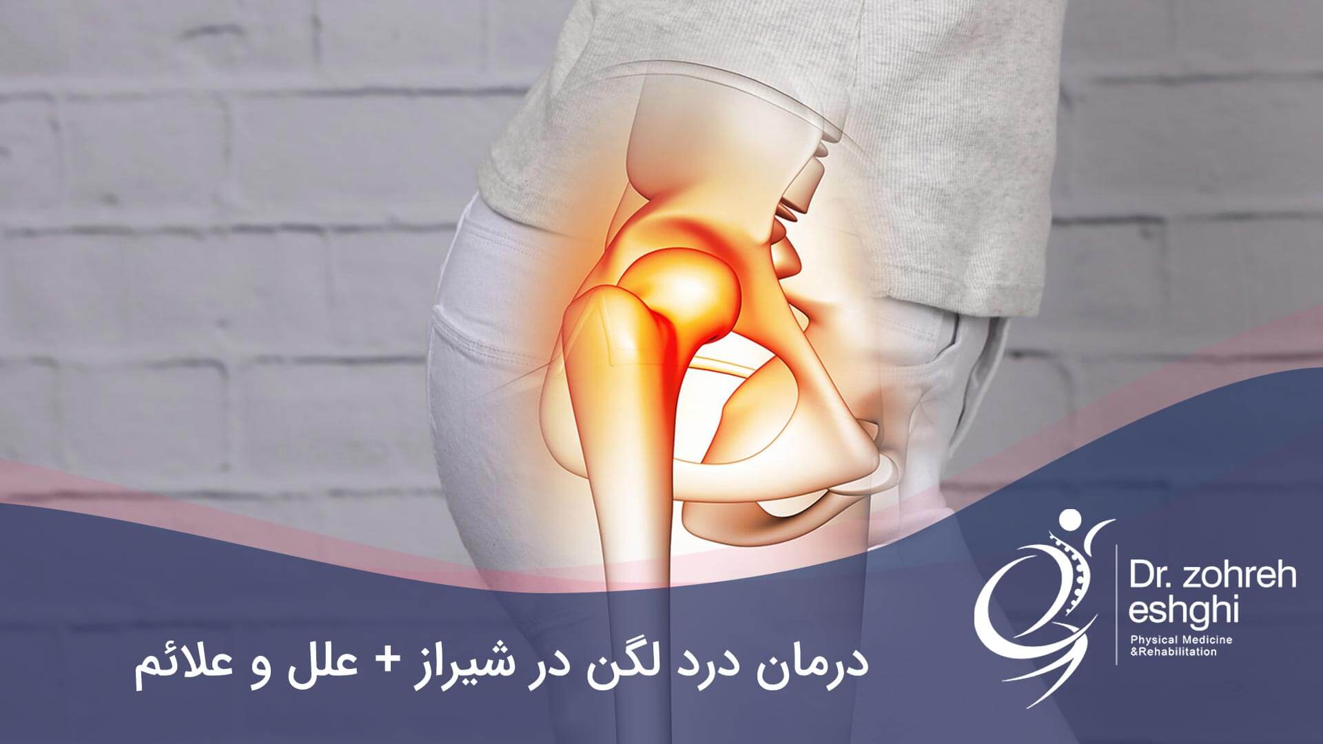 درمان درد لگن در شیراز + علل و علائم آن