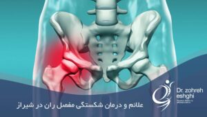 درمان شکستگی مفصل ران