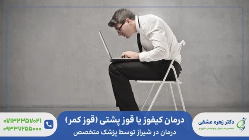 درمان قوز کمر ، کیفوز پشتی یا کیفوز کمر در شیراز