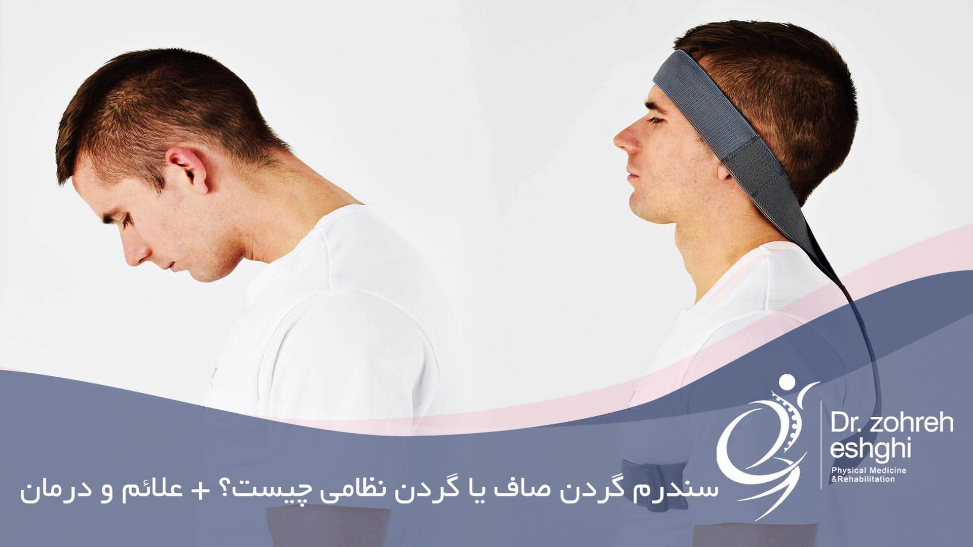 سندرم گردن صاف یا گردن نظامی چیست + علائم و درمان