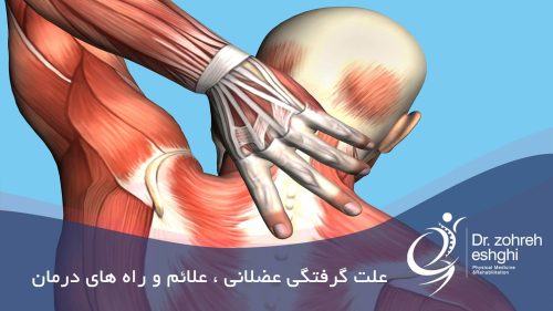 گرفتگی عضلانی