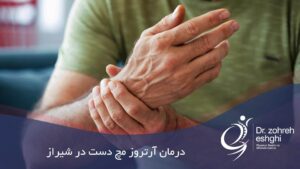 درمان آرتروز مچ دست در شیراز