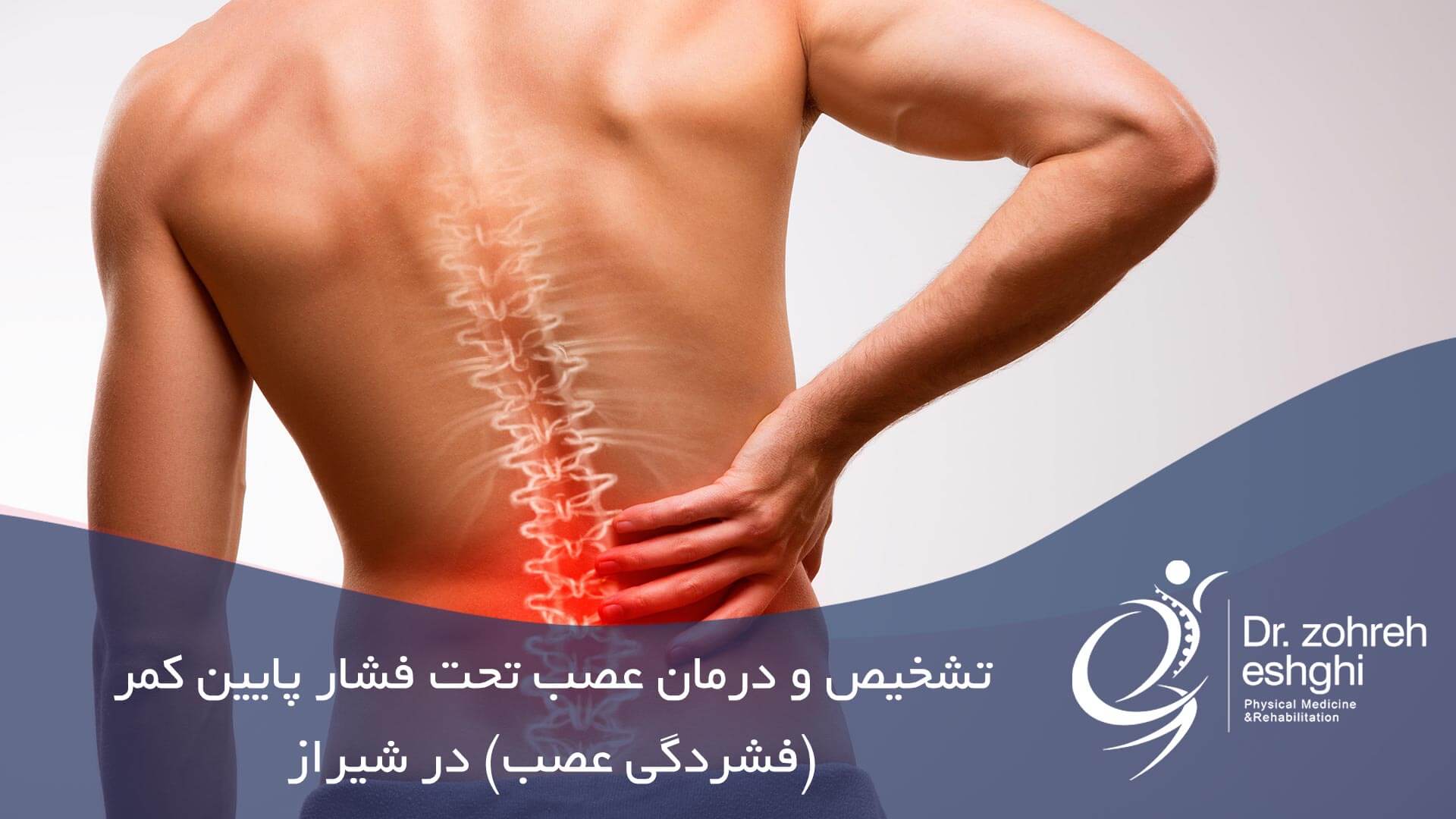 تشخیص و درمان عصب تحت فشار پایین کمر (فشردگی عصب) در شیراز