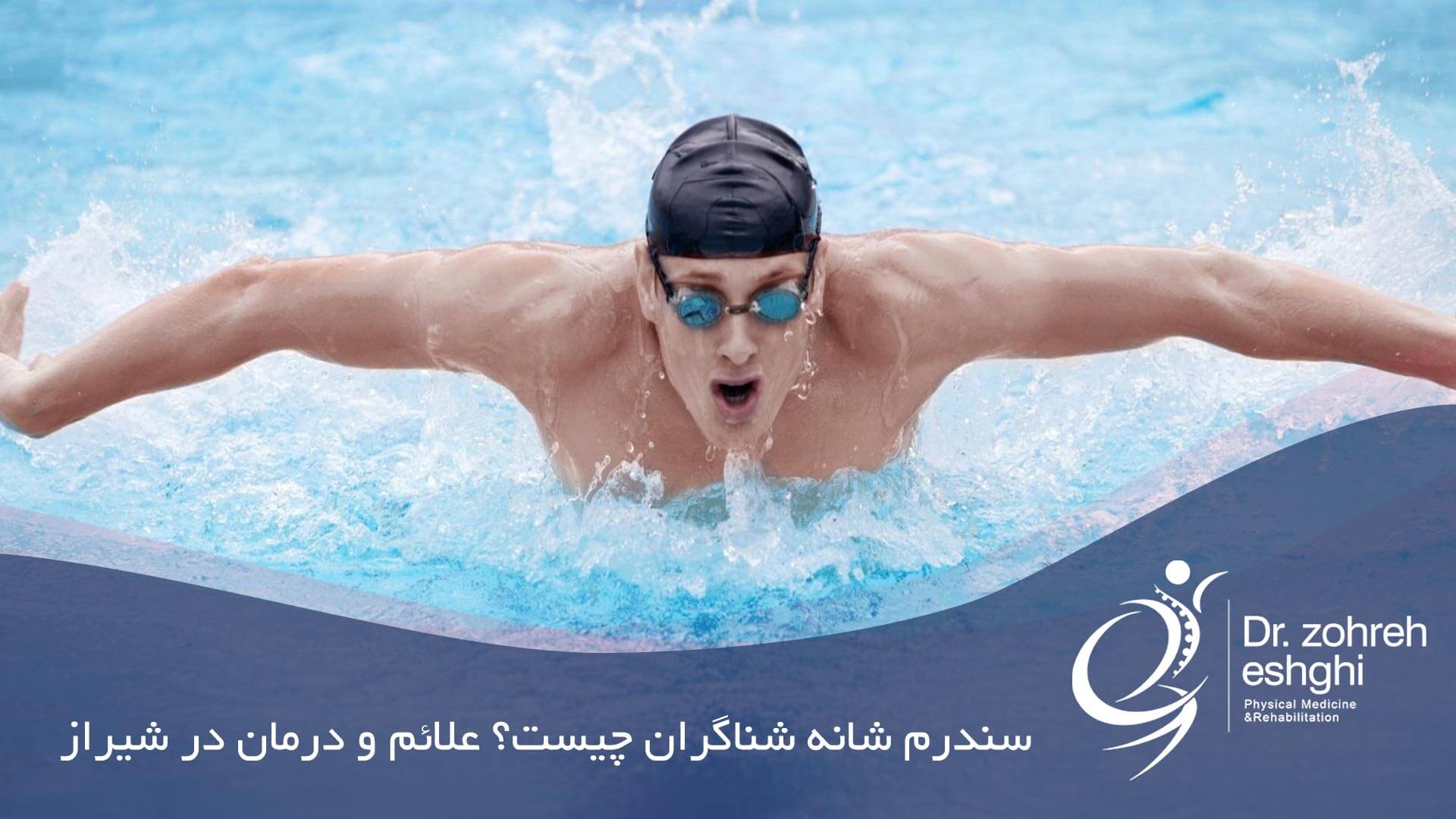 سندرم شانه شناگران چیست؟ علائم و درمان در شیراز