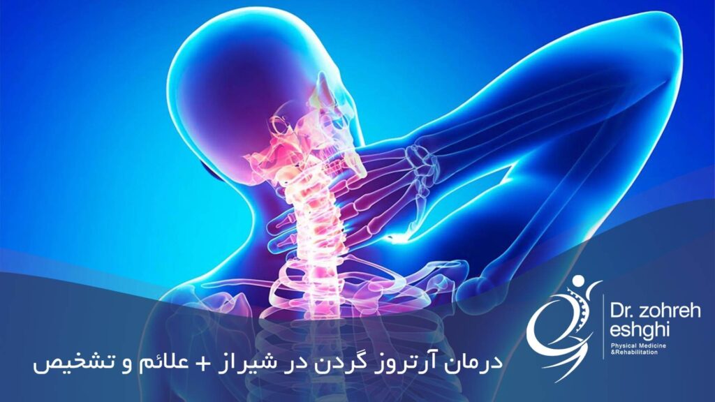 درمان آرتروز گردن در شیراز + تشخیص و علائم آن
