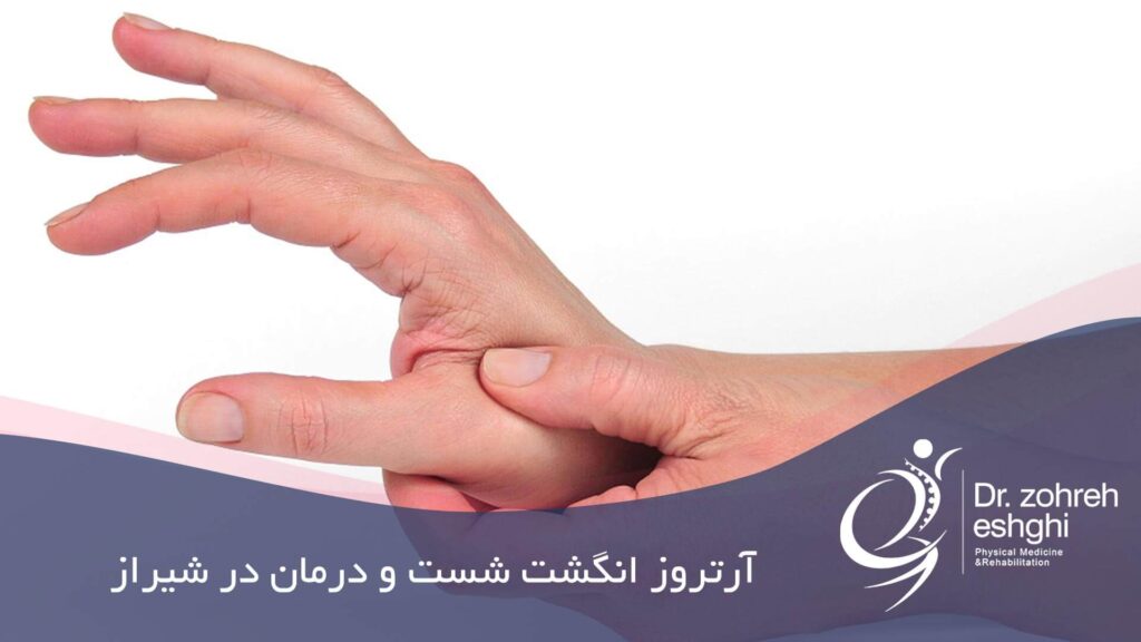 درمان آرتروز انگشت شست