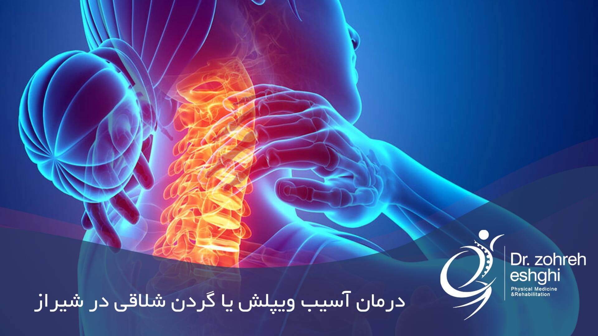 درمان آسیب گردن شلاقی (ویپلش) در شیراز