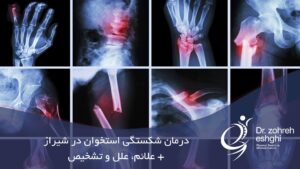 درمن شکستگی استخوان در شیراز