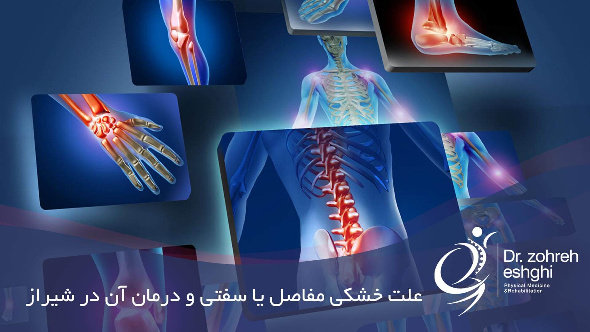 علت خشکی مفاصل یا سفتی و درمان در شیراز