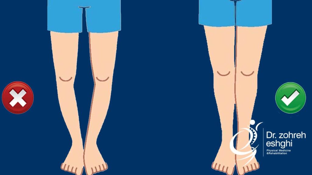 آزمایش و تشخیص پای پرانتزی