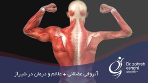 درمان آتروفی عضلانی در شیراز