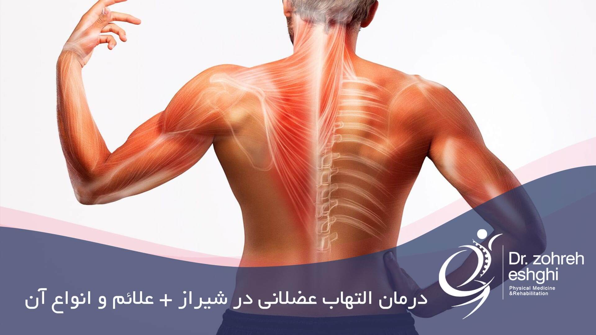 درمان التهاب عضلانی در شیراز