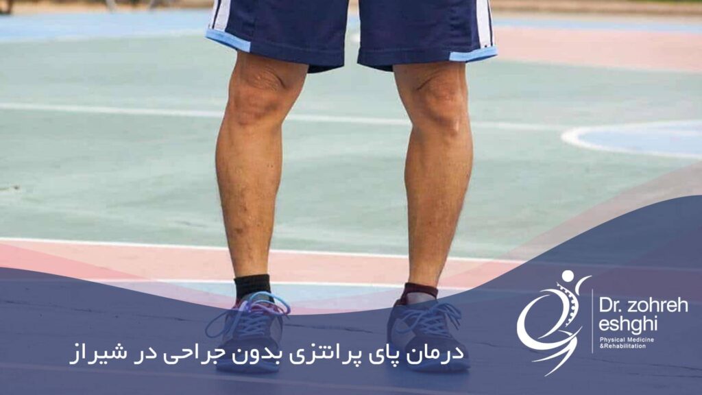 درمان پای پرانتزی بدون جراحی