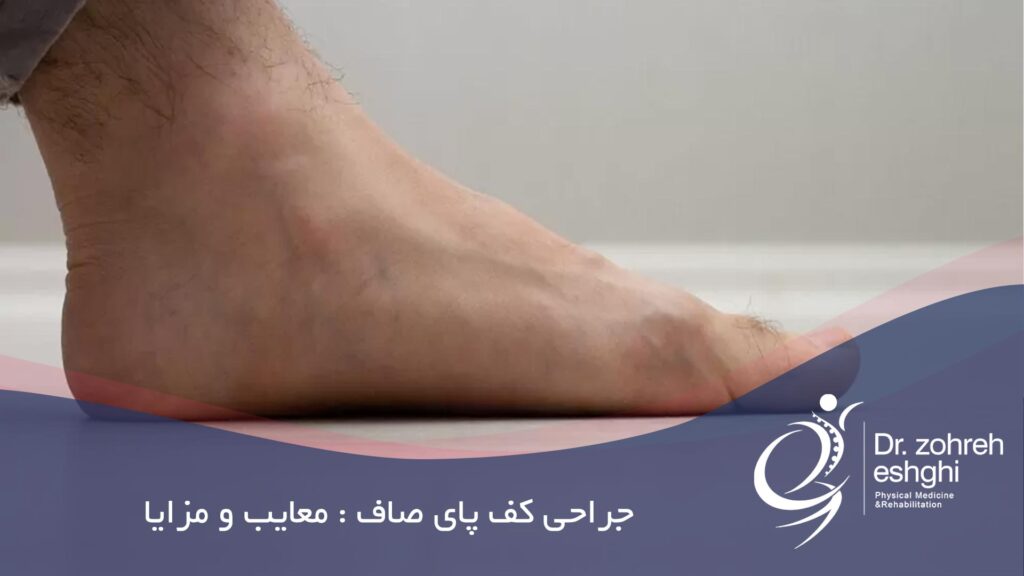 جراحی کف پای صاف در شیراز : معایب و مزایا