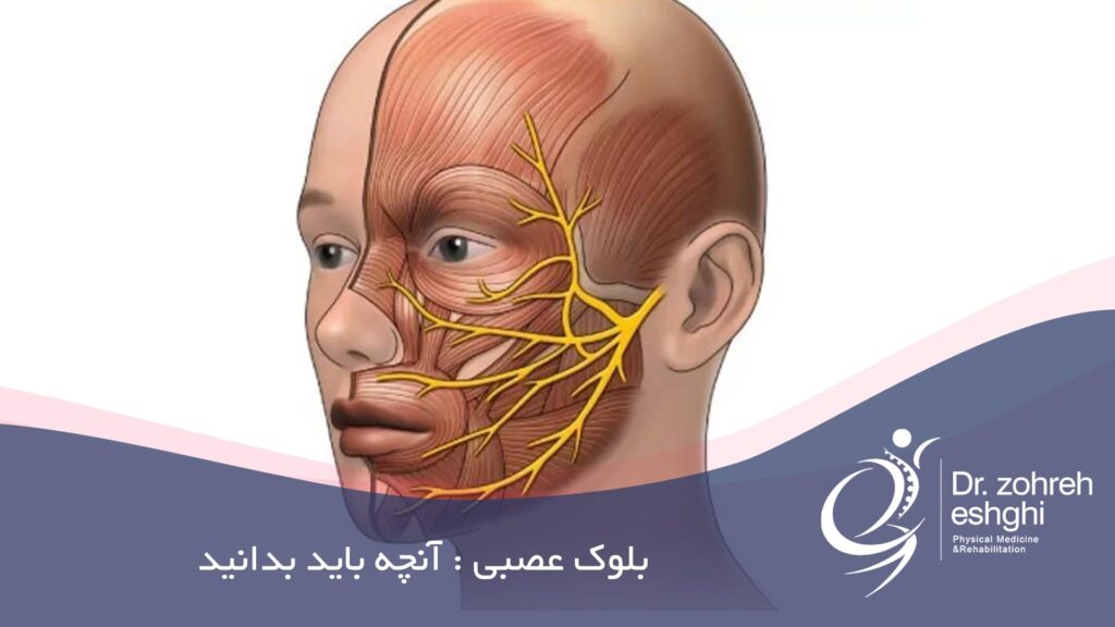 بلوک عصبی چیست