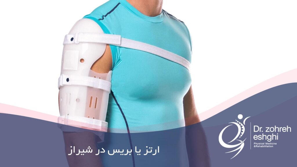 ارتز یا بریس در شیراز