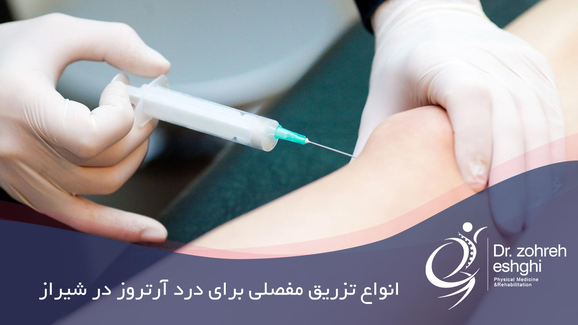 انواع تزریق مفصلی برای درد آرتروز در شیراز