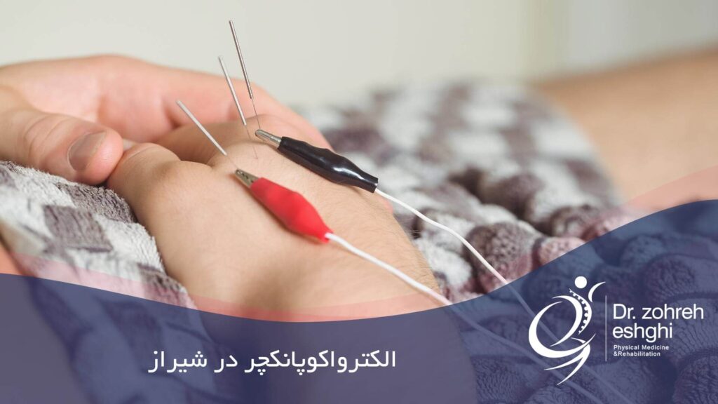 الکترواکوپانکچر در شیراز