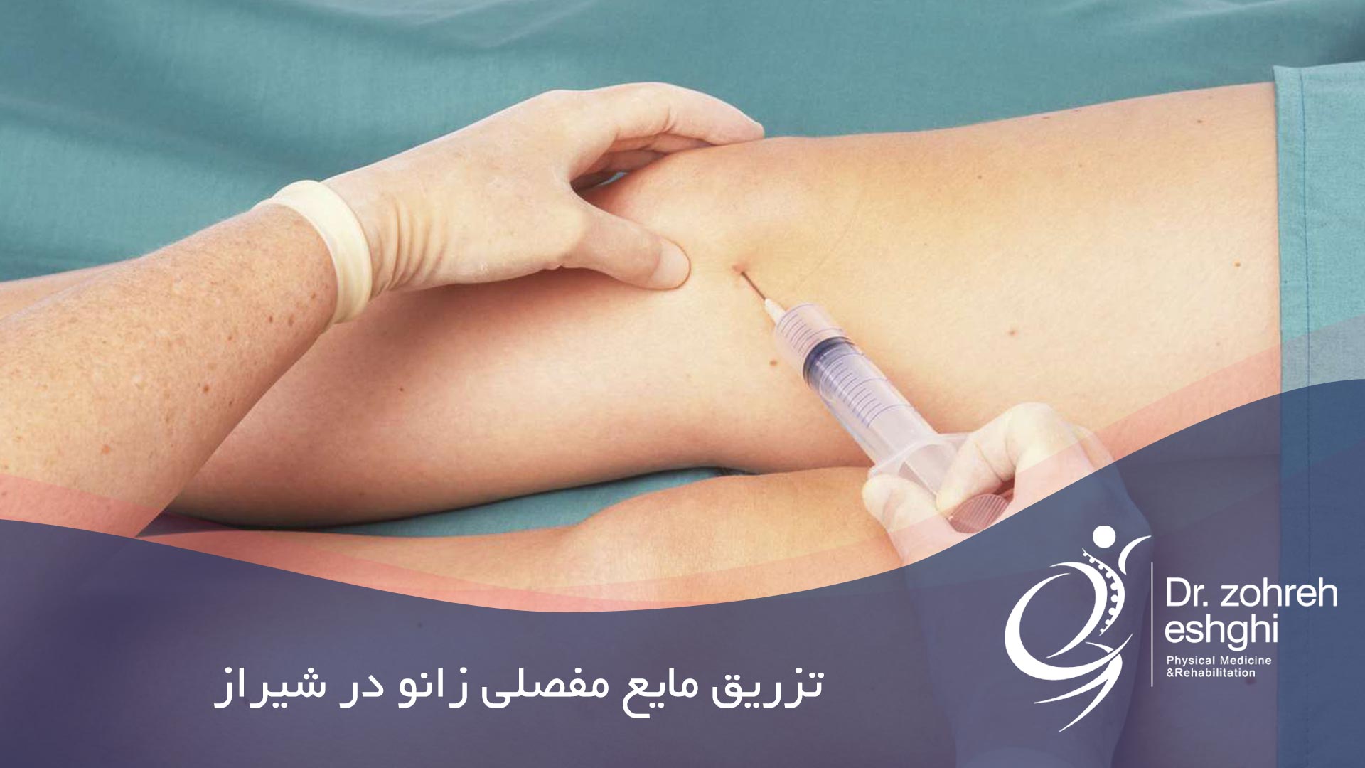 تزریق مایع مفصلی زانو در شیراز